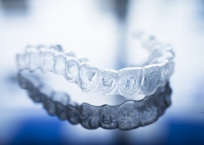 Clear aligners